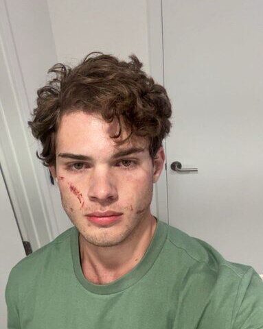 Lo que se sabe de la hospitalización de Clavicular por una posible sobredosis