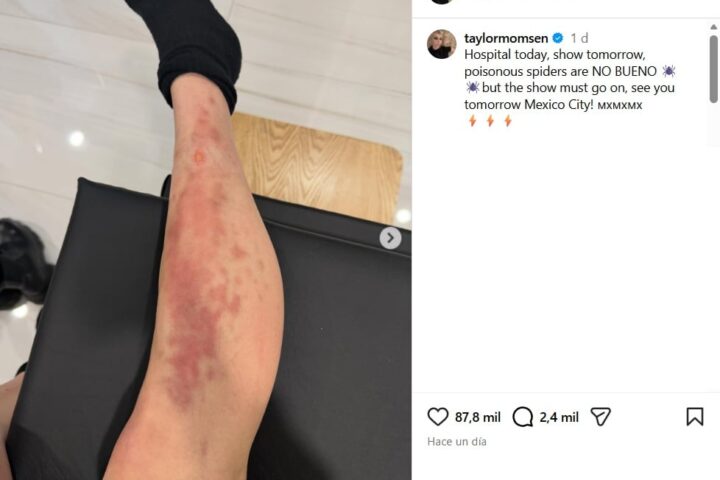 Taylor Momsen fue hospitalizada por picadura de araña en CDMX