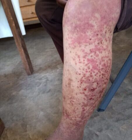 Advierte Contec falta de médico y medicamentos en Baborigame