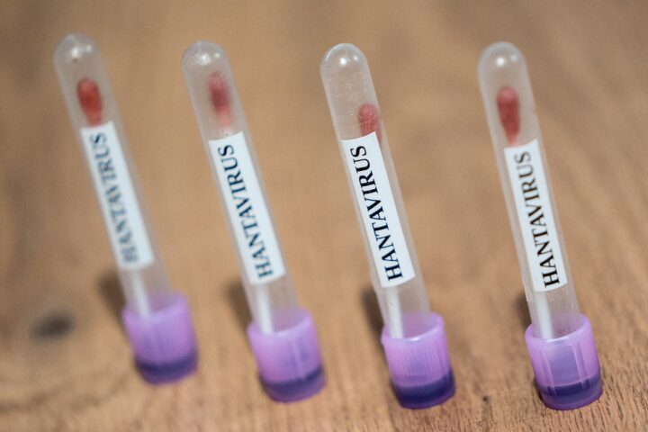 Hantavirus