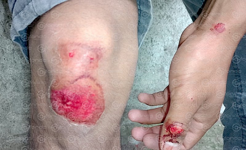 Falsos agentes viales provocan choque contra motociclista y escapan en vehículo sospechoso