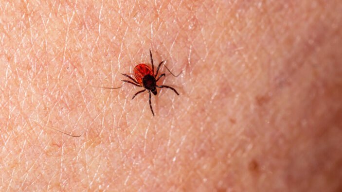Letalidad por rickettsiosis alcanza cifras alarmantes con más de cincuenta decesos en la región