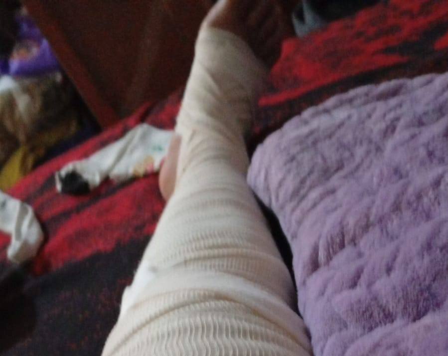 A dos años de una fractura laboral, mujer enfrenta el abandono institucional y la falta de pensión