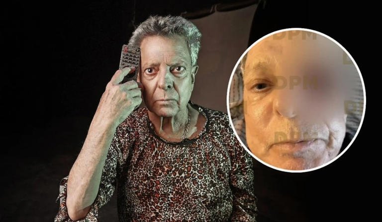 Familia de César Bono aclara el estado de salud del actor y descarta pérdida de la vista
